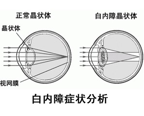 搜索